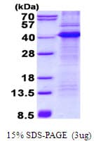 Human CD68 Protein (Recombinant His)