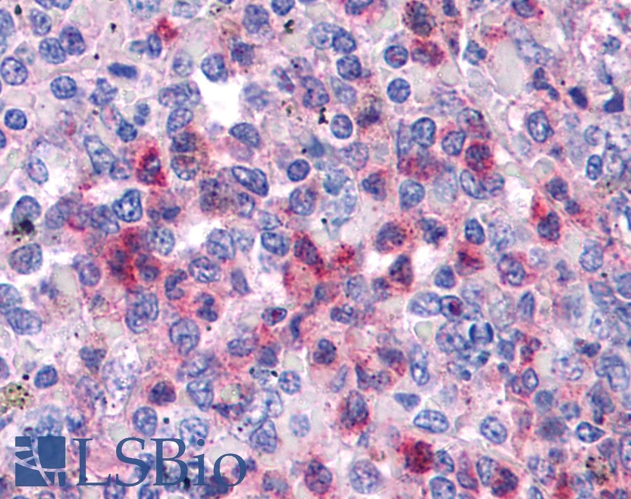 SGK3 Antibody (aa107-156)