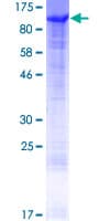 Human CHML Protein (Recombinant GST)