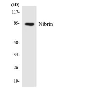 NBN / Nibrin Antibody (aa225-274)