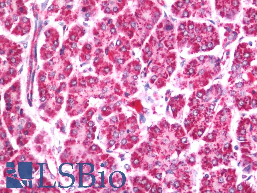 IHC-plus™ ASH1L / ASH1 Antibody (aa2919-2969)