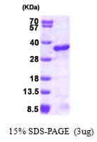 Human UBE2S / E2 EPF Protein (Recombinant His)