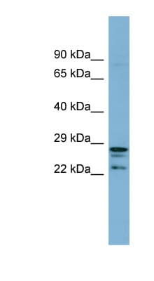 CUTC Antibody (aa107-156)