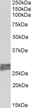 Polyclonal Goat anti-Human TNNI3 / Cardiac Troponin I Antibody (aa117-127, IF, WB)