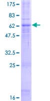 Human CCR5 Protein (Recombinant GST)