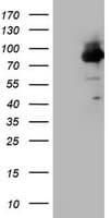 F13A1 / Factor XIIIa Antibody (clone OTI8E2, Carrier-free)