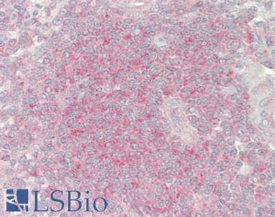 IHC-plus™ RABEP1 / Rabaptin-5 Antibody (aa812-862)