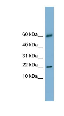 LGALS14 / CLC2 Antibody (N-Terminus)