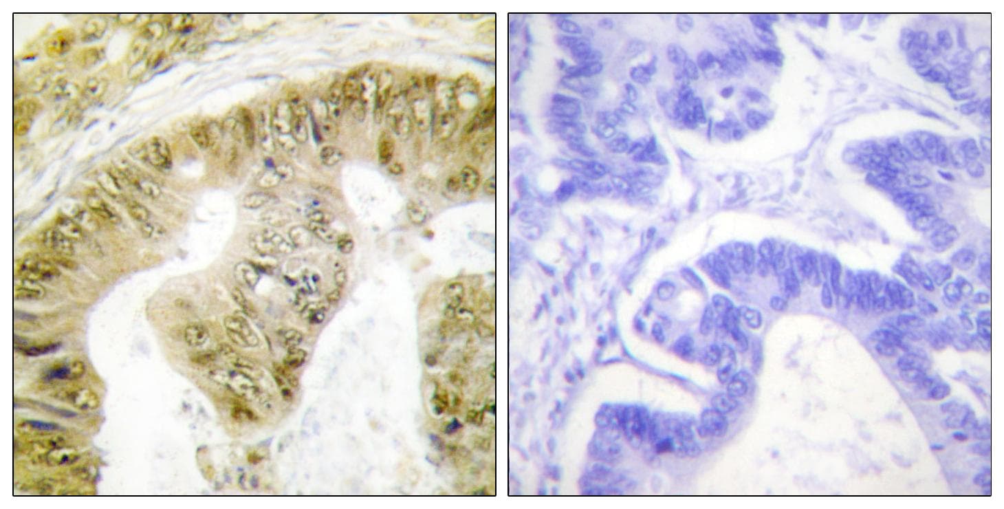FANCA Antibody (phospho-Ser1149)
