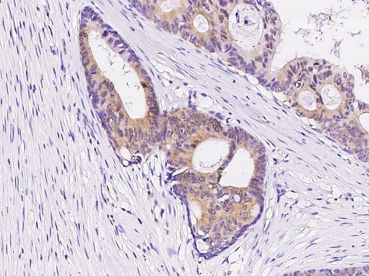 Polyclonal Rabbit anti-Human NRBP2 Antibody (IHC)