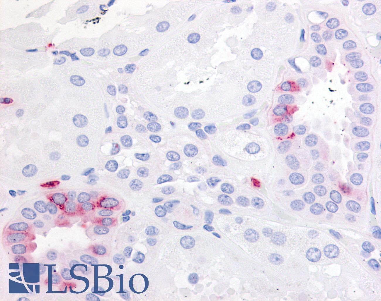IHC-plus™ PTGER2 / EP2 Antibody (Extracellular Domain)