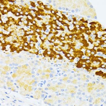 Polyclonal Rabbit anti-Human DDIT3 / CHOP Antibody (IHC, WB)