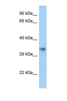 AKR1E2 Antibody (C-Terminus)