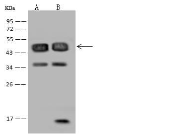 RBM17 Antibody