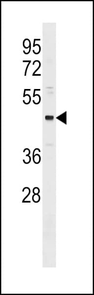 ONECUT3 / OC3 Antibody (aa393-419)