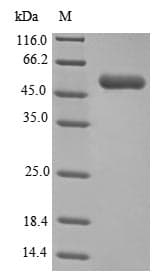 Peptoclostridium difficile GLUD1/Glutamate Dehydrogenase Protein (Recombinant 6His, N-terminus)