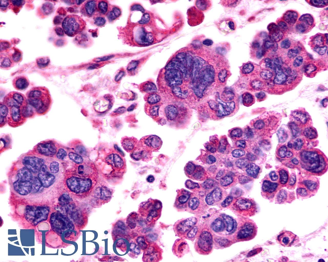 PathPlus™ ADGRV1 / GPR98 Antibody (N-Terminus)