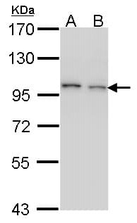 Polyclonal Rabbit anti-Human EPS8 Antibody (aa761-822, IHC, WB)
