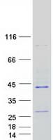 Human RPUSD1 Protein (Recombinant Myc-DDK (Flag))