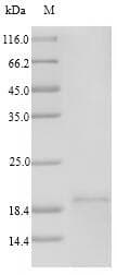 Human TSLP Protein (Recombinant 6His, N-terminus)