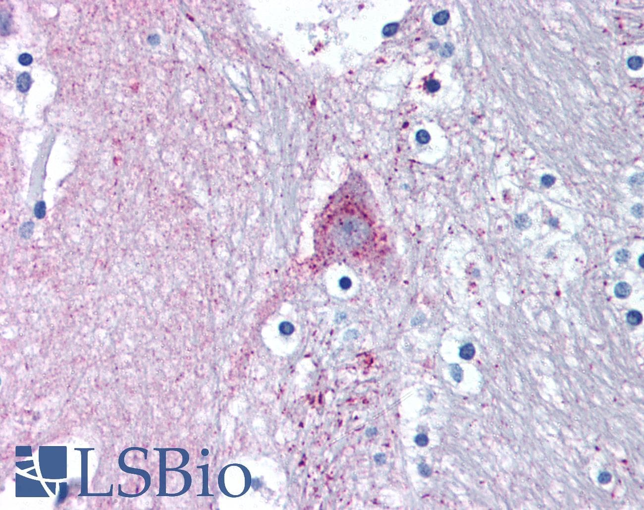 IHC-plus™ MARK1 / MARK Antibody (N-Terminus)