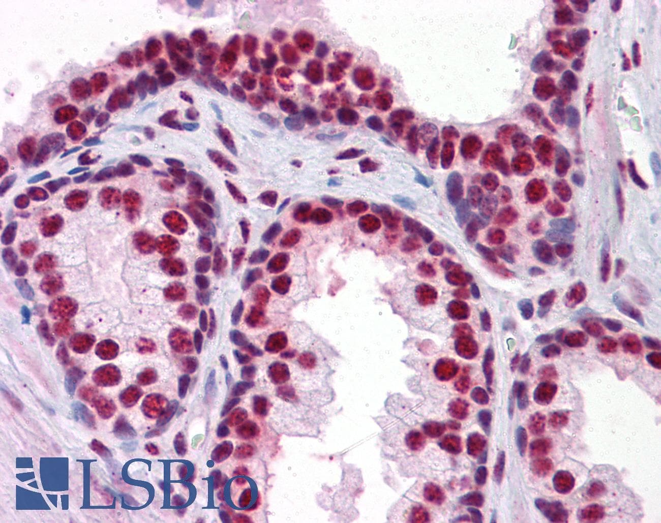 IHC-plus™ CBFA1 / RUNX2 Antibody (clone 3F5)