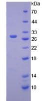 Mouse HEXA Protein (Recombinant His, N-Terminal)