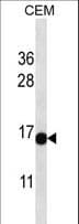 ATAD4 Antibody (aa75-103)