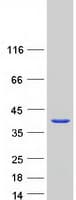 Human GAL4 / Galectin 4 Protein (Recombinant Myc-DDK (Flag))