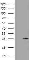 TIMP2 Antibody (clone OTI3G7)