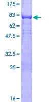 Human PAK1 Protein (Recombinant GST)