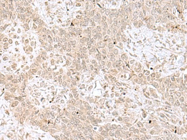RPL35 / Ribosomal Protein L35 Antibody