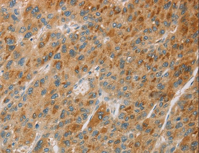 Polyclonal Rabbit anti-Human CYP11B1 Antibody (IHC)