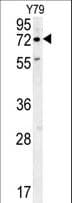 Polyclonal Rabbit anti-Human RFT1 Antibody (aa513-541, IHC, WB)