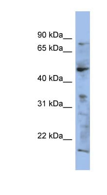 Polyclonal Rabbit anti-Human RAB3IP / RABIN3 Antibody (aa107-156, WB)