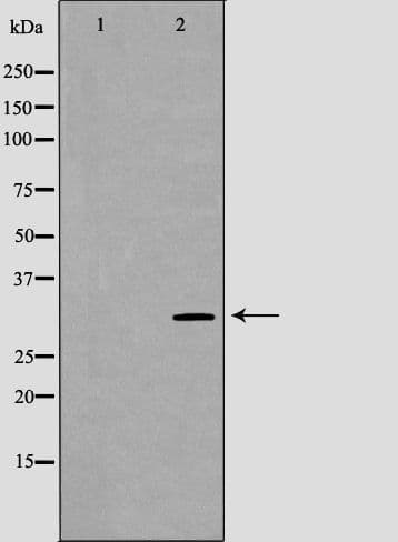 Polyclonal Rabbit anti-Human NRG1 / Heregulin / Neuregulin Antibody (IHC, WB)