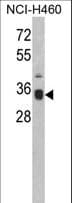 SPP1 / Osteopontin Antibody (aa273-301)