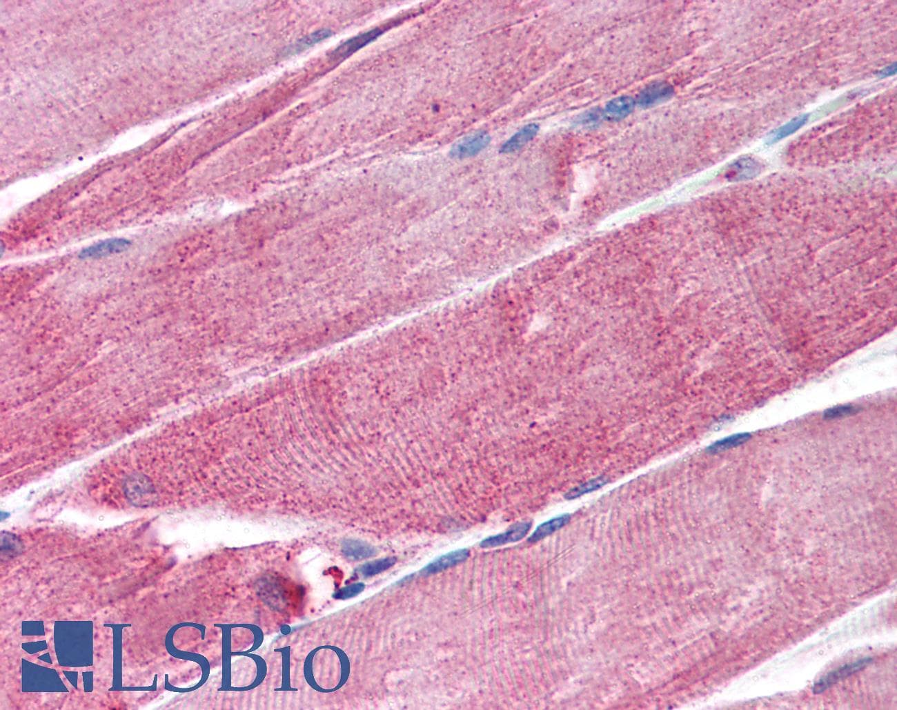 IHC-plus™ MURF1 / IRF Antibody (aa247-261)