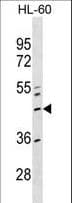 Polyclonal Rabbit anti-Human ZNF589 Antibody (aa184-210, WB)