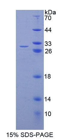 Human EEF1A1 Protein (Recombinant His-T7)