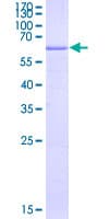 Human HLA-G Protein (Recombinant GST)