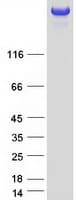 Human SDK2 Protein (Recombinant Myc-DDK (Flag))