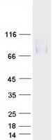 Human LAMP2 / CD107b Protein (Recombinant Myc-DDK (Flag))