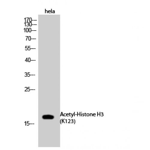 Polyclonal Rabbit anti-Human Histone H3 Antibody (C-terminal, WB)