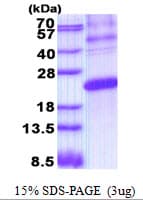 Human ESM1 / Endocan Protein (Recombinant His)