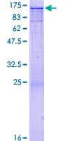 Human c-CBL Protein (Recombinant GST)