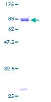 Human SH3P7 / HIP-55 Protein (Recombinant GST)