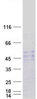 Human NOTUM Protein (Recombinant Myc-DDK (Flag))