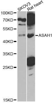 ASAH1 / Acid Ceramidase Antibody
