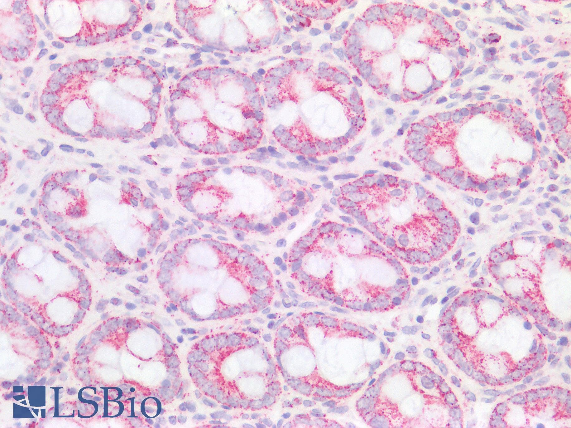 IHC-plus™ CD95 / FAS Antibody (N-Terminus)